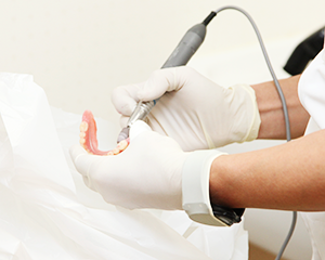 治療が完了した後も、口腔衛生増進や機能回復の為に「定期的な口腔ケア」をオススメしています。 入れ歯(義歯)の調整・作製